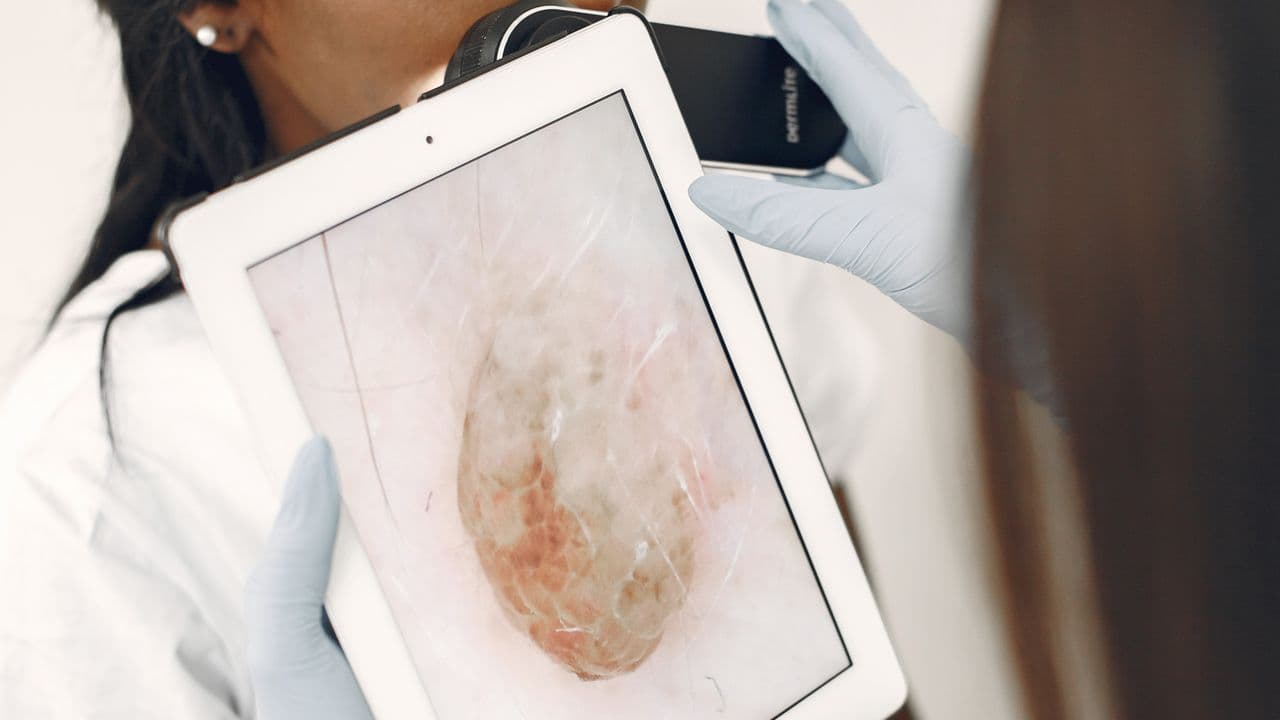 Dermatology